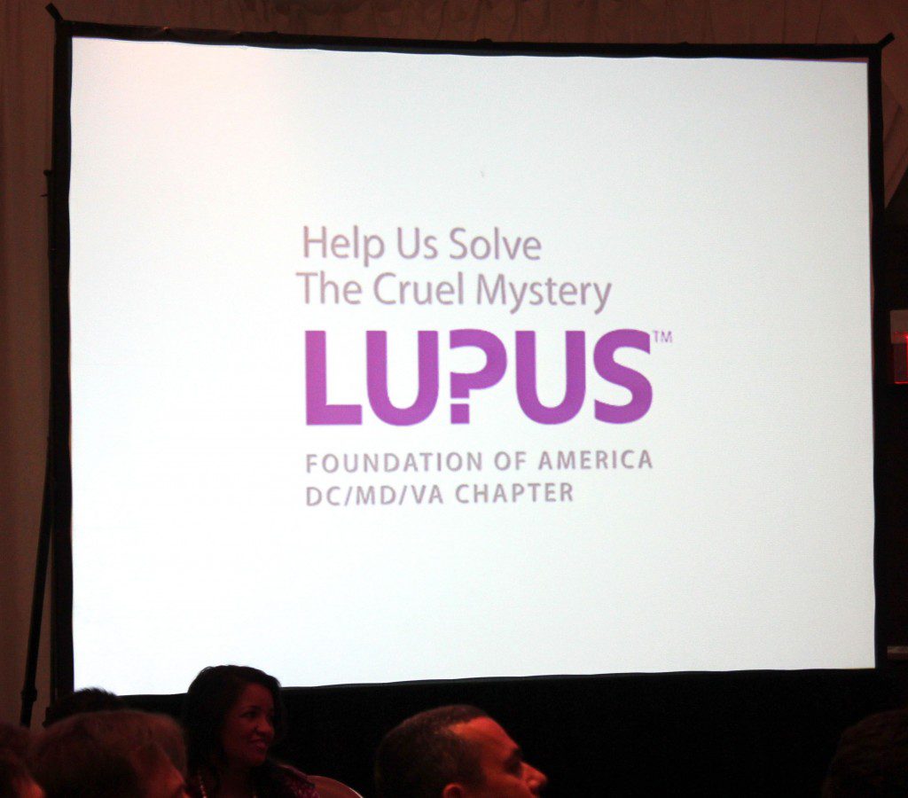 Lupus